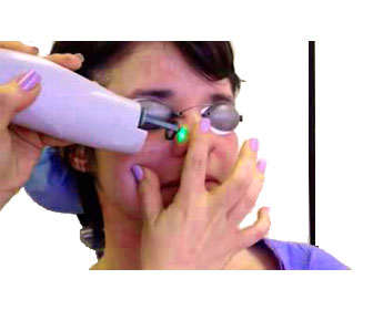tratamiento cuperosis nariz