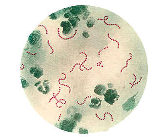 Cultivo in vitro de streptococcus pyogenes